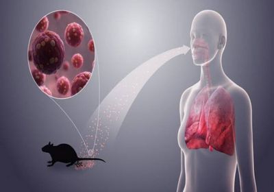 منظمة الصحة تقلل من تفشي هانتا 