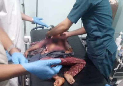 استشهاد 4 أطفال وإصابة 8 آخرين في انفجار بالضالع