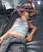 دماء الطفولة في الضالع.. الجنوب يدفع ضريبة الصمود في وجه الإرهاب الحوثي