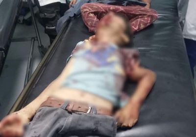 دماء الطفولة في الضالع.. الجنوب يدفع ضريبة الصمود في وجه الإرهاب الحوثي