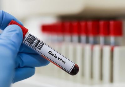 الصحة الفرنسية تعلن تسجيل أول حالة إصابة بـ"إيبولا"