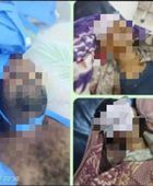 7 قتلى في اعتداء مسلح على اللواء الرابع درع الوطن في رماة