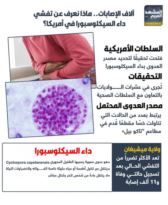 آلاف الإصابات.. ماذا نعرف عن تفشي داء السيكلوسبورا فى أمريكا؟ (إنفوجراف)