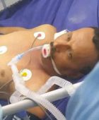 أحد ضحايا القصف السعودي.. استشهاد عبدالرحيم الردفاني بعد غيبوبة لـ8 أشهر