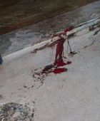 إصابة متظاهر بجروح إثر إطلاق النار على مسيرة سلمية في المكلا