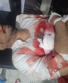 مقتل التاجر أحمد الكثيري في كمين مسلح قرب أحور بأبين
