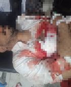 مقتل التاجر أحمد الكثيري في كمين مسلح قرب أحور بأبين